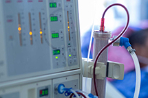 Hemodialysis